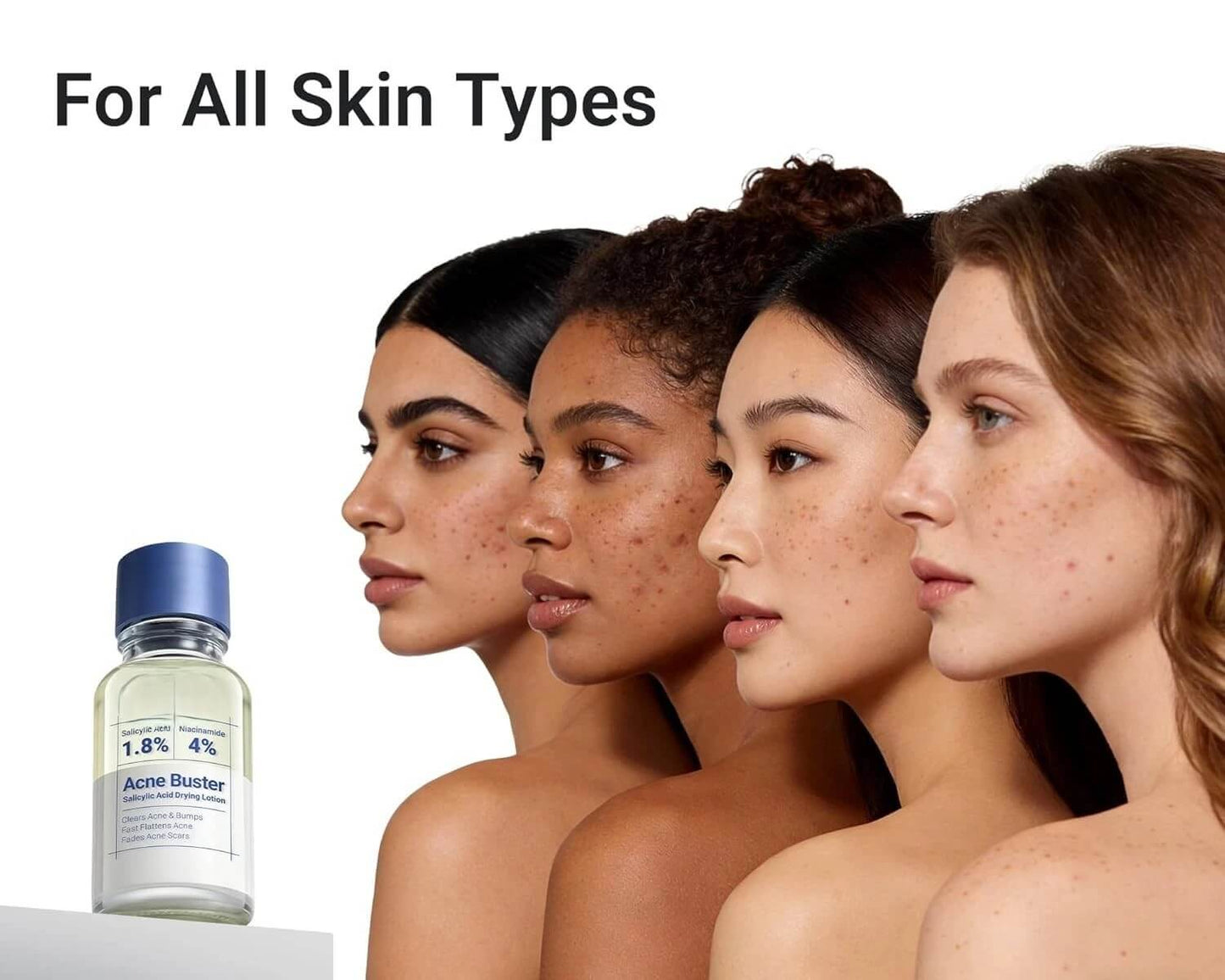 glowPure™ Acne Buster