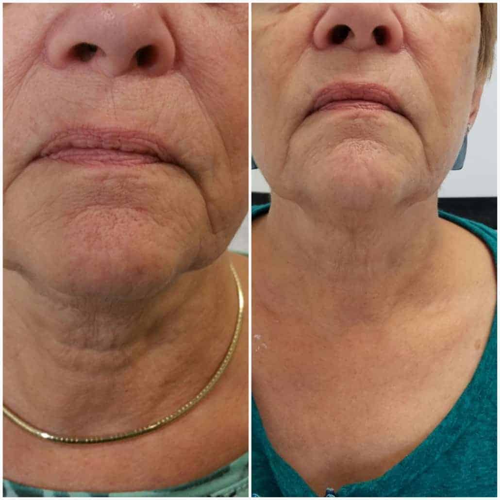 glowPure™ Everyday Bundle