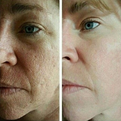 glowPure™ Premium LED Mask